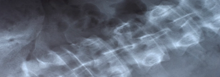 Chiropractic-Glasgow-KY-Digital-XRays-1.webp low back pain relief with chiropractic care